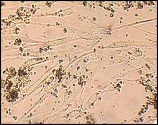 Кристаллы минерального компонента костной ткани -  «Аллогенный гидроксиапатит» серии «Лиопласт»®  рН > 8